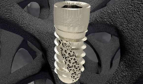 6K Additive will process Z3DLab’s proprietary ZTi alloys through its UniMelt technology to produce spherical, dense powders to be used for Additive Manufacturing (Courtesy 6K Additive)